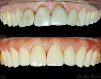 Max Dent - Klinikë dentare, Dental Clinic in Albania, Dental Tourism Albania