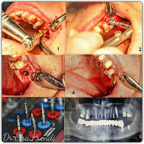 Max Dent - Klinikë dentare, Dental Clinic in Albania, Dental Tourism Albania