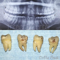 Max Dent - Klinikë dentare, Dental Clinic in Albania, Dental Tourism Albania