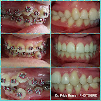 Max Dent - Klinikë dentare, Dental Clinic in Albania, Dental Tourism Albania