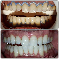 Max Dent - Klinikë dentare, Dental Clinic in Albania, Dental Tourism Albania