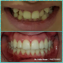 Max Dent - Klinikë dentare, Dental Clinic in Albania, Dental Tourism Albania