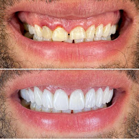 Dental Med Austria & Elixence