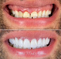 Dental Med Austria & Elixence