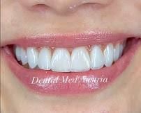 Dental Med Austria & Elixence