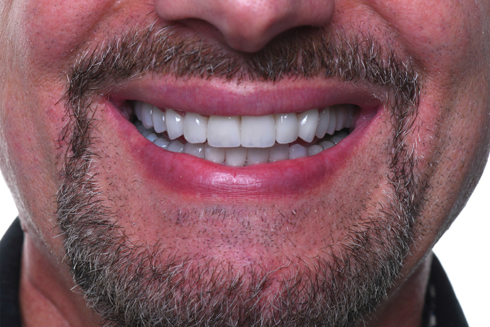 Travel And Smile Dental Clinic - dental clinic in Tirana, Albania