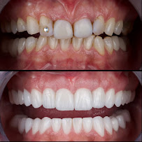 AlVital - Clinica Dentale Albania