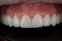 AlVital - Clinica Dentale Albania