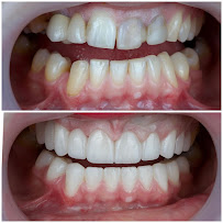 AlVital - Clinica Dentale Albania