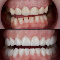 AlVital - Clinica Dentale Albania