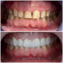 AlVital - Clinica Dentale Albania