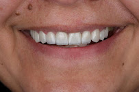 AlVital - Clinica Dentale Albania