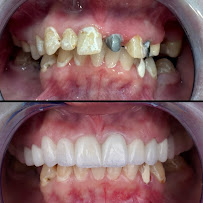 AlVital - Clinica Dentale Albania