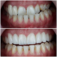 AlVital - Clinica Dentale Albania