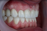 AlVital - Clinica Dentale Albania