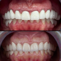 AlVital - Clinica Dentale Albania