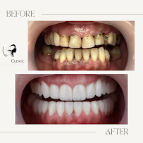 AlVital - Clinica Dentale Albania