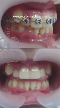 Zeus Dental Clinic - Dentisti in Albania