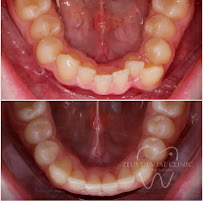 Zeus Dental Clinic - Dentisti in Albania