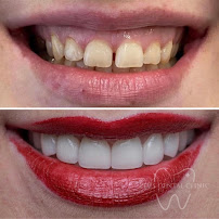 Zeus Dental Clinic - Dentisti in Albania