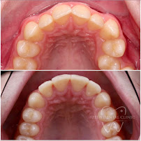 Zeus Dental Clinic - Dentisti in Albania