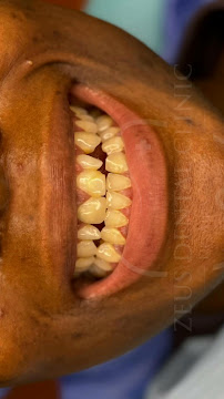 Zeus Dental Clinic - Dentisti in Albania