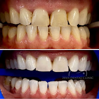 Zeus Dental Clinic - Dentisti in Albania