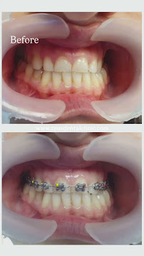 Zeus Dental Clinic - Dentisti in Albania