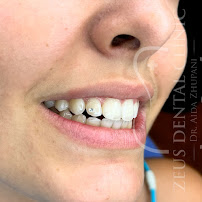 Zeus Dental Clinic - Dentisti in Albania