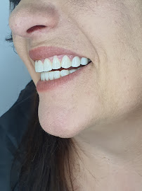 Perfect Dental Center