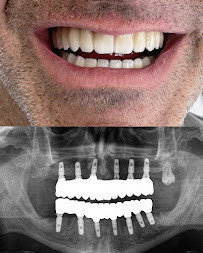 Sota Dental, Advanced Implantology Center