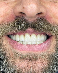 Sota Dental, Advanced Implantology Center