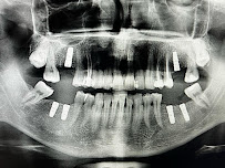 Sota Dental, Advanced Implantology Center