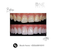 One Dental