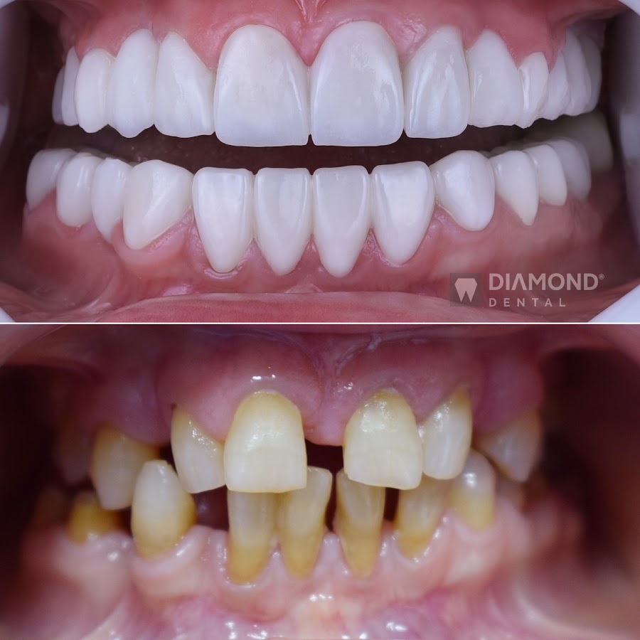 Diamond Dental Hospital - dental clinic in Tirana, Albania