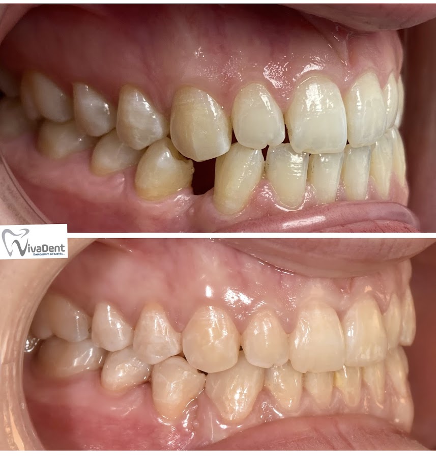 Klinika Dentare VivaDent - dental clinic in Tirana, Albania