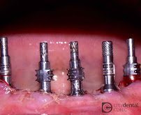 City Dental Clinic CDC - Dentisti in Albania