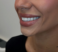 "LELA DENTAL" Dr.Shk.Fatmir Lela
