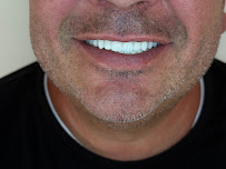 "LELA DENTAL" Dr.Shk.Fatmir Lela