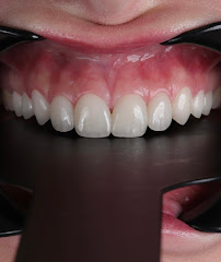 Durres Dental Clinic