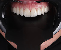 Durres Dental Clinic