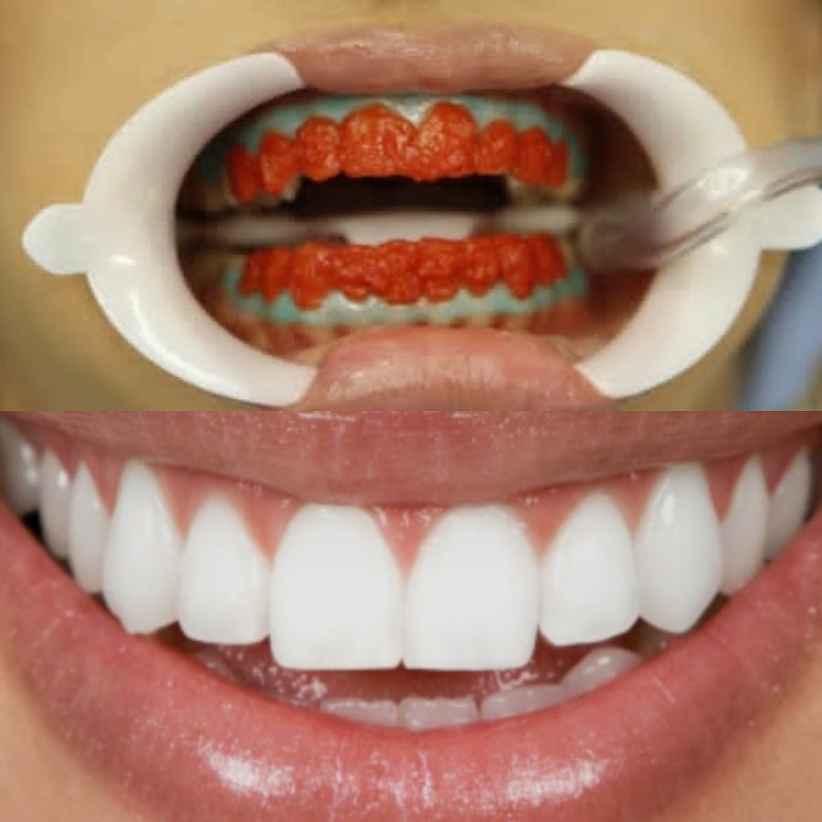 Ami Dental - Dental Clinic in Durrës - dental clinic in Durres, Albania