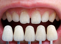 Dential - Clinica Dentale Odontoiatrica