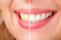 Dential - Clinica Dentale Odontoiatrica