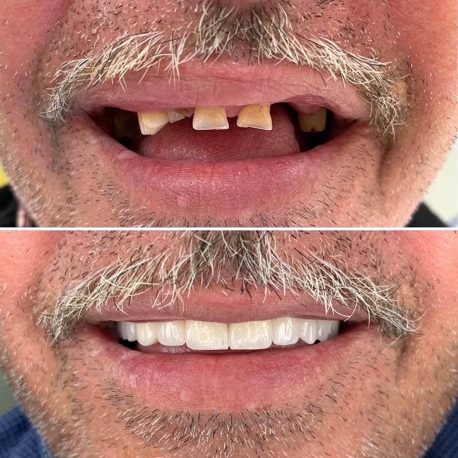 Blerina Dent - dental clinic in Durres, Albania