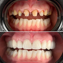 BLERINA DENT Vollga - Dr. Blerina Bani Topra - Dentist Durres ,Albania Pro Implants & Aesthetic Dentistry