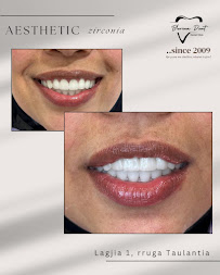 BLERINA DENT Vollga - Dr. Blerina Bani Topra - Dentist Durres ,Albania Pro Implants & Aesthetic Dentistry