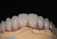 BLERINA DENT Vollga - Dr. Blerina Bani Topra - Dentist Durres ,Albania Pro Implants & Aesthetic Dentistry