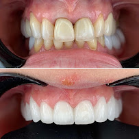 BLERINA DENT Vollga - Dr. Blerina Bani Topra - Dentist Durres ,Albania Pro Implants & Aesthetic Dentistry