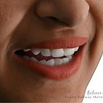 BLERINA DENT Vollga - Dr. Blerina Bani Topra - Dentist Durres ,Albania Pro Implants & Aesthetic Dentistry